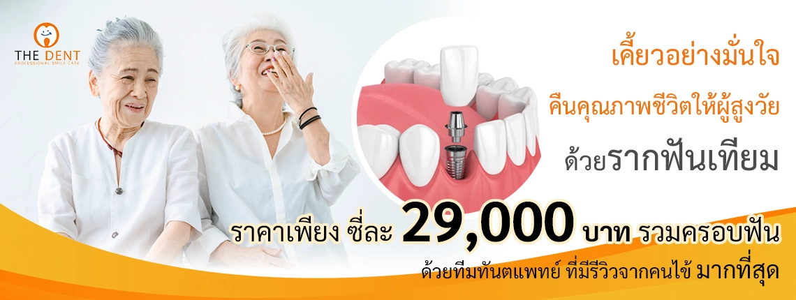 ทำรากฟันเทียม ราคา