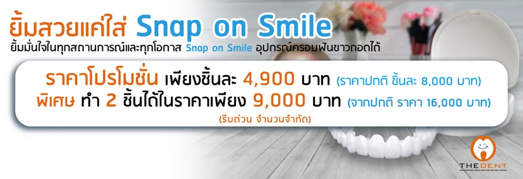 ฟันขาวถอดได้ Snap on Smile 4,900 บาท พิเศษทำ 2 ชิ้น 9,000