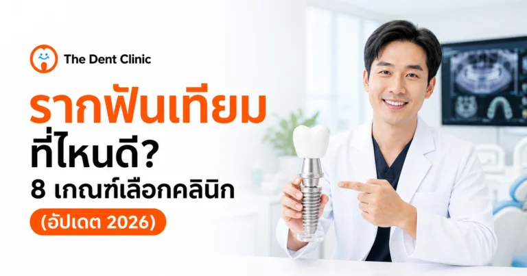 รากฟันเทียมที่ไหนดี 8 เกณฑ์เลือกคลินิกก่อนตัดสินใจ
